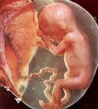 embrião humano